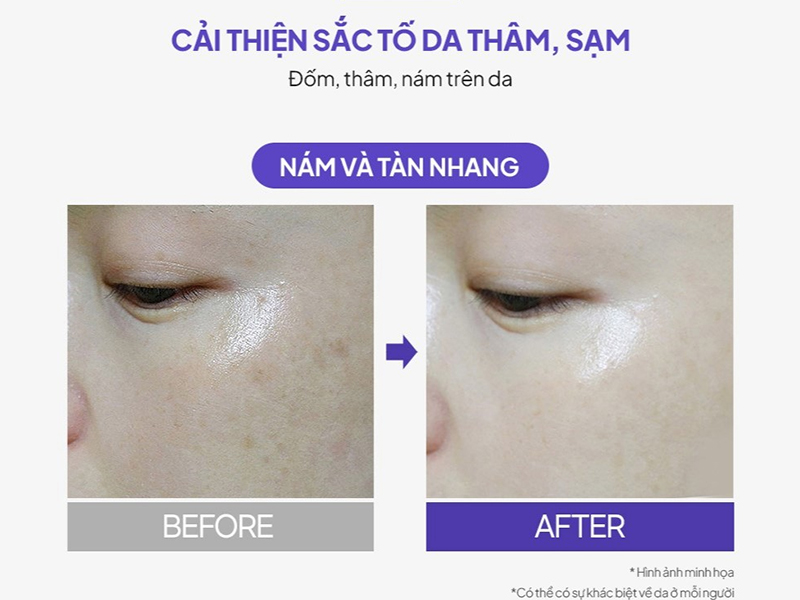 Kem dưỡng da mờ thâm sạm nám chuyên sâu Maxclinic