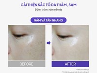 Kem dưỡng da mờ thâm sạm nám chuyên sâu Maxclinic hũ 50ml