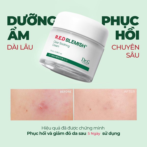 Kem dưỡng phục hồi cho da dầu mụn Dr G Blemish Clear Soothing Cream 70ml