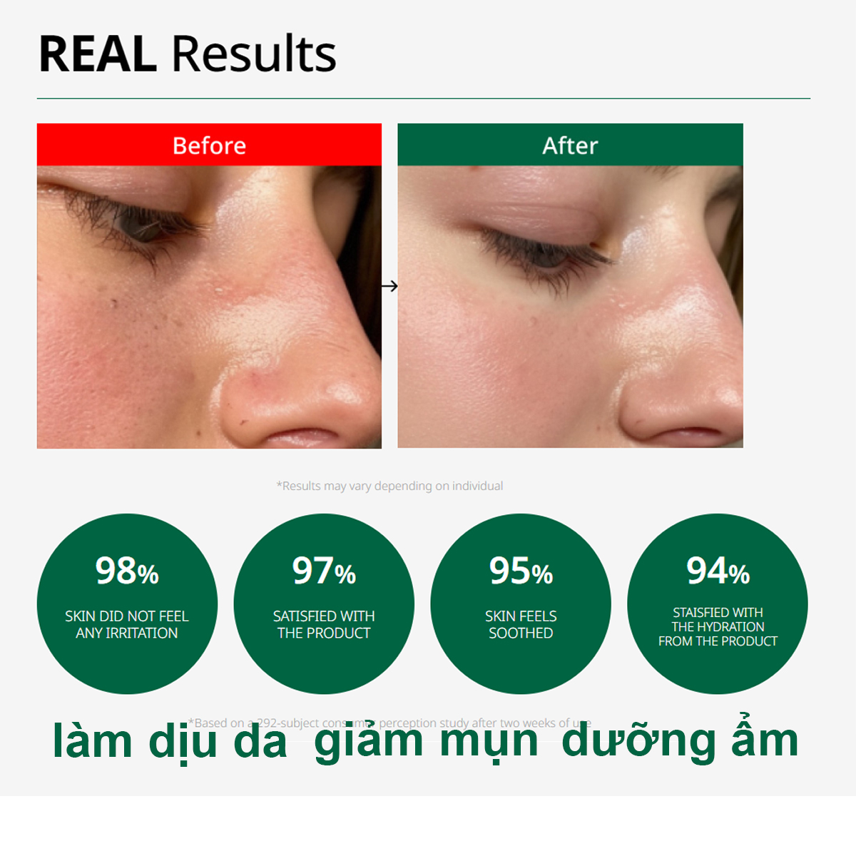 Kem dưỡng phục hồi cho da dầu mụn Dr G Blemish Clear Soothing Cream 70ml