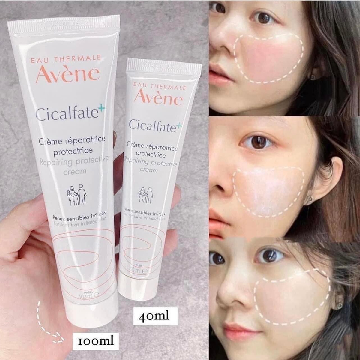 Kem dưỡng ẩm phục hồi da, trị sẹo thâm avene cicafate cream 100ml