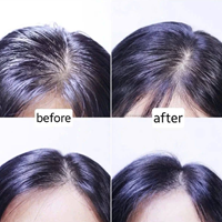 Tinh chất Đặc Trị Rụng Tóc RYO Root:Gen For Scalp 150ml