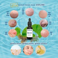Serum ngừa mụn mờ thâm nám chống lão hóa Oviline 15ml