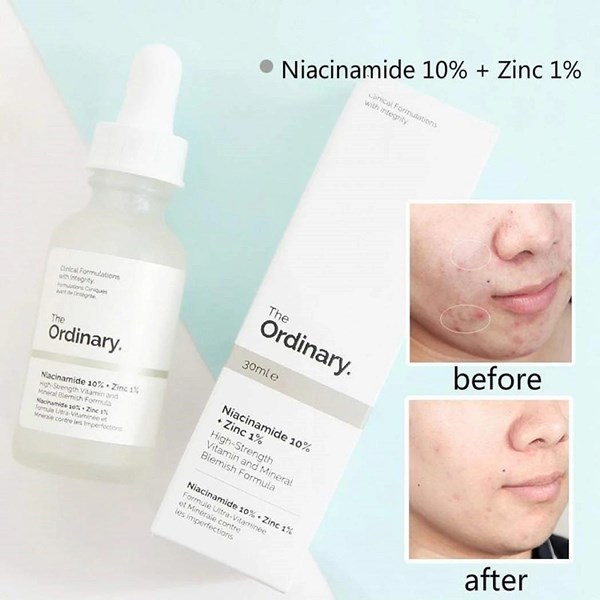 Tinh chất trị mụn, se khít lỗ chân lông The Ordinary Niacinamide 10% + Zinc 1% 30ml